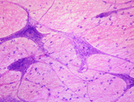 20070306204023-neurona-2.gif