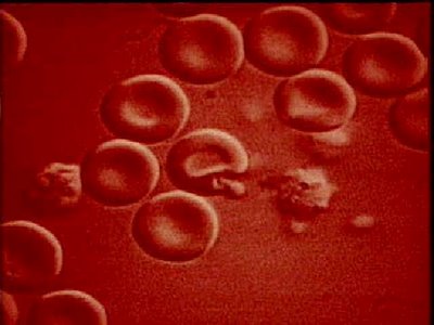 20081119202219-malaria-virus.jpg