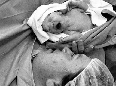 20090204180348-parto-dolor.jpg