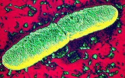 20090326141346-pestis-big.jpg